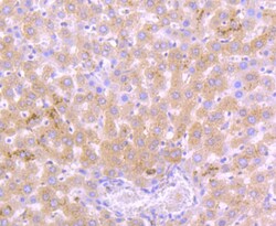 Invitrogen Cathepsin D Polyclonal Antibody 100 &mu;L; Unconjugated:Antibodies,