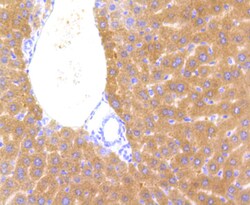 Invitrogen CYP2E1 Polyclonal Antibody 100 &mu;L; Unconjugated:Antibodies,