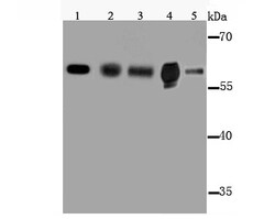 Invitrogen CYP2E1 Polyclonal Antibody 100 &mu;L; Unconjugated:Antibodies,