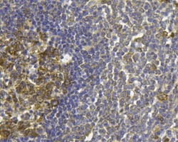 Invitrogen FPR1 Polyclonal Antibody 100 &mu;L; Unconjugated:Antibodies,