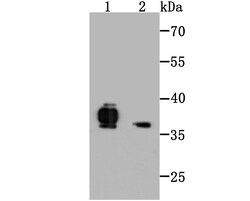 Invitrogen FPR1 Polyclonal Antibody 100 &mu;L; Unconjugated:Antibodies,