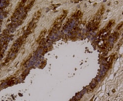 Invitrogen LYRIC Polyclonal Antibody 100 &mu;L | Buy Online | Invitrogen&trade; | Fisher Scientific