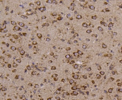 Invitrogen LYRIC Polyclonal Antibody 100 &mu;L | Buy Online | Invitrogen&trade; | Fisher Scientific