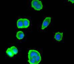 Invitrogen SMAD3 Polyclonal Antibody 100 &mu;L | Buy Online | Invitrogen&trade; | Fisher Scientific