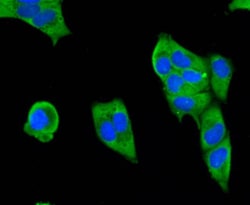 Invitrogen SMAD3 Polyclonal Antibody 100 &mu;L | Buy Online | Invitrogen&trade; | Fisher Scientific