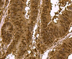 Invitrogen SMAD3 Polyclonal Antibody 100 &mu;L | Buy Online | Invitrogen&trade; | Fisher Scientific