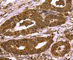 Invitrogen SMAD3 Polyclonal Antibody 100 &mu;L | Buy Online | Invitrogen&trade; | Fisher Scientific
