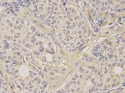 Invitrogen FGFR2 Polyclonal Antibody 100 &mu;L; Unconjugated:Antibodies,
