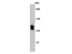Invitrogen FGFR2 Polyclonal Antibody 100 &mu;L; Unconjugated:Antibodies,
