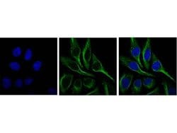 Invitrogen SQSTM1 Polyclonal Antibody 100 &mu;L | Buy Online | Invitrogen&trade; | Fisher Scientific