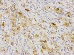 Invitrogen SQSTM1 Polyclonal Antibody 100 &mu;L | Buy Online | Invitrogen&trade; | Fisher Scientific