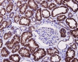 Invitrogen JNK1 Polyclonal Antibody 100 &mu;L; Unconjugated:Antibodies,