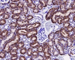 Invitrogen JNK1 Polyclonal Antibody 100 &mu;L; Unconjugated:Antibodies,