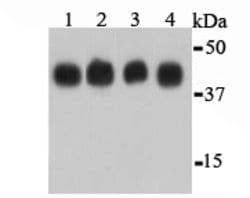 Invitrogen beta Actin Polyclonal Antibody 100 &mu;L; Unconjugated:Antibodies,