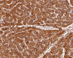 Invitrogen Sigma-1 Receptor Polyclonal Antibody 100 &mu;L; Unconjugated:Antibodies,