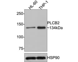 Invitrogen PLCB2 Polyclonal Antibody 100 &mu;L; Unconjugated:Antibodies,