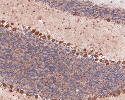 Invitrogen PLCB3 Polyclonal Antibody 100 &mu;L; Unconjugated:Antibodies,