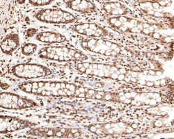 Invitrogen SOX3 Polyclonal Antibody 100 μL; Unconjugated:Antibodies,