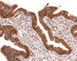 Invitrogen SOX3 Polyclonal Antibody 100 μL; Unconjugated:Antibodies,