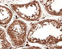 Invitrogen SOX3 Polyclonal Antibody 100 μL; Unconjugated:Antibodies,