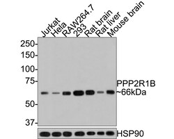 Invitrogen PPP2R1B Polyclonal Antibody 100 &mu;L; Unconjugated:Antibodies,