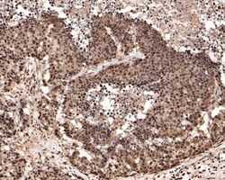 Invitrogen PGBD5 Polyclonal Antibody 100 &mu;L; Unconjugated:Antibodies,