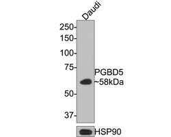 Invitrogen PGBD5 Polyclonal Antibody 100 &mu;L; Unconjugated:Antibodies,
