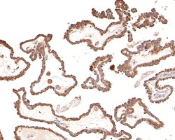 Invitrogen DAB2IP Polyclonal Antibody 100 μL; Unconjugated:Antibodies,