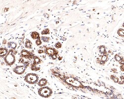 Invitrogen IRAK1 Polyclonal Antibody 100 &mu;L; Unconjugated:Antibodies,