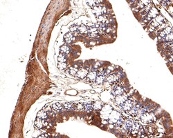 Invitrogen IRAK1 Polyclonal Antibody 100 &mu;L; Unconjugated:Antibodies,