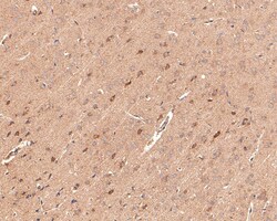 Invitrogen IRAK1 Polyclonal Antibody 100 &mu;L; Unconjugated:Antibodies,