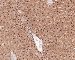 Invitrogen PSME4 Polyclonal Antibody 100 μL; Unconjugated:Antibodies,