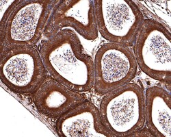 Invitrogen 14-3-3 zeta Polyclonal Antibody 100 μL; Unconjugated:Antibodies,