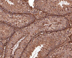 Invitrogen 14-3-3 zeta Polyclonal Antibody 100 μL; Unconjugated:Antibodies,