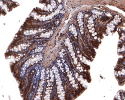 Invitrogen 14-3-3 zeta Polyclonal Antibody 100 μL; Unconjugated:Antibodies,