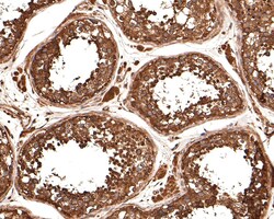 Invitrogen TUBA3C Polyclonal Antibody 100 &mu;L | Buy Online | Invitrogen&trade; | Fisher Scientific