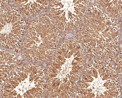 Invitrogen TUBA3C Polyclonal Antibody 100 &mu;L | Buy Online | Invitrogen&trade; | Fisher Scientific