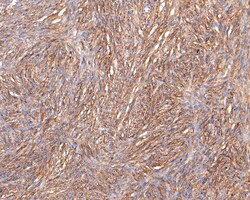 Invitrogen Podoplanin Polyclonal Antibody 100 &mu;L; Unconjugated:Antibodies,