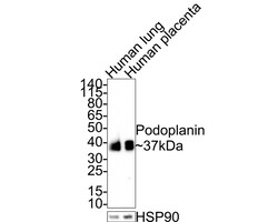 Invitrogen Podoplanin Polyclonal Antibody 100 &mu;L; Unconjugated:Antibodies,