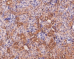 Invitrogen USP8 Polyclonal Antibody 100 &mu;L | Buy Online | Invitrogen&trade; | Fisher Scientific