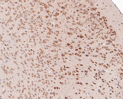 Invitrogen YTHDF1 Polyclonal Antibody 100 &mu;L; Unconjugated:Antibodies,