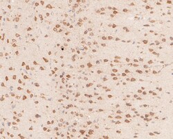 Invitrogen YTHDF1 Polyclonal Antibody 100 &mu;L; Unconjugated:Antibodies,