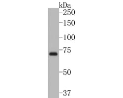Invitrogen TCCR Polyclonal Antibody 100 &mu;L; Unconjugated:Antibodies,
