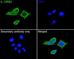 Invitrogen IL12RB2 Polyclonal Antibody 100 &mu;L; Unconjugated:Anticuerpos