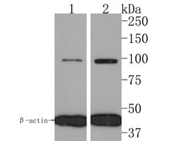 Invitrogen IL12RB2 Polyclonal Antibody 100 &mu;L; Unconjugated:Anticuerpos