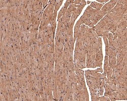 Invitrogen CNTFR Polyclonal Antibody 100 μL; Unconjugated:Antibodies,