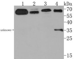 Invitrogen CNTFR Polyclonal Antibody 100 μL; Unconjugated:Antibodies,