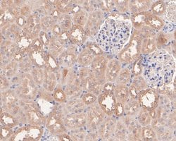 Invitrogen beta-1,2 Adaptin Polyclonal Antibody 100 &mu;L; Unconjugated:Antibodies,