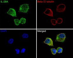 Invitrogen IL-28A Polyclonal Antibody 100 &mu;L; Unconjugated:Antibodies,