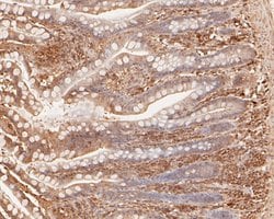Invitrogen IL-28A Polyclonal Antibody 100 &mu;L; Unconjugated:Antibodies,